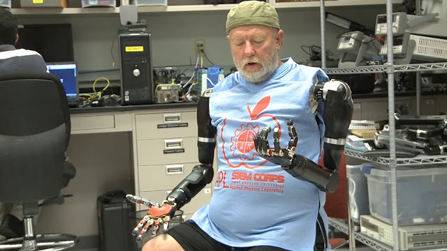 double-amputee-controls-two-prosthetic-arms-just-his-mind
