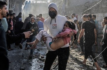 Palestinian-Children-Injured-Israeli-Raids