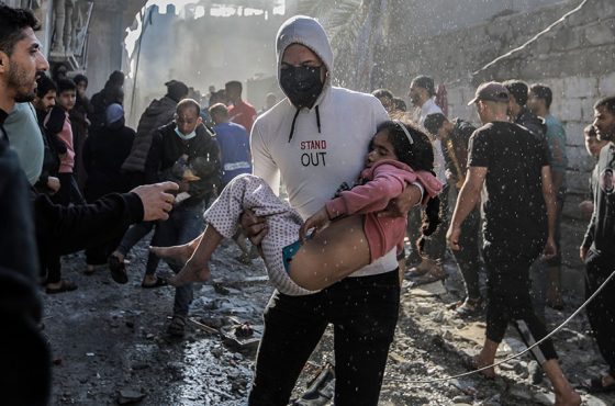 Palestinian-Children-Injured-Israeli-Raids
