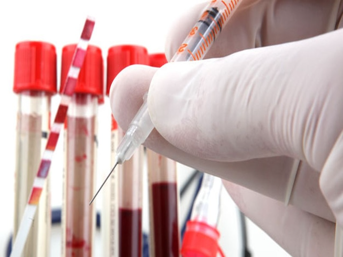 Blood Test Suicide Prediction Genuine Concern or Big Pharma Money Grab?