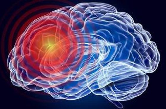 stroke-speech-comprehension