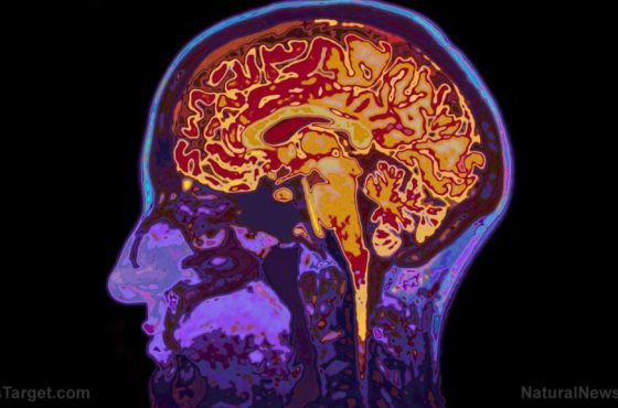 Mri-Image-Head-Showing-Brain