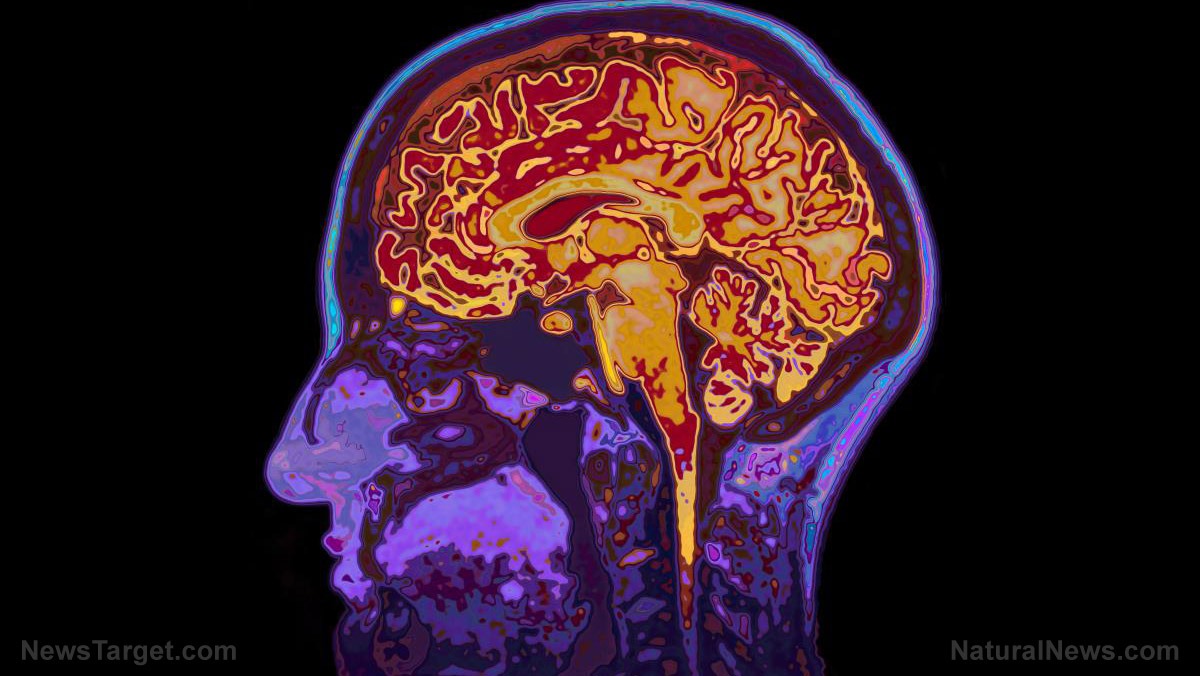 Mri-Image-Head-Showing-Brain