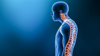 curved-back-kyphosis curved-back-kyphosis
